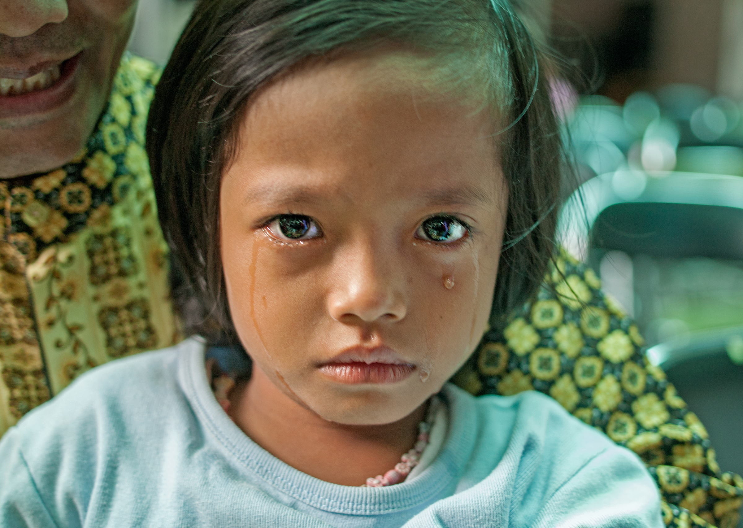 A young girl cries after being circumcised in Bandung, Indonesia